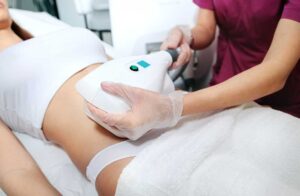 The Top Weight Loss Benefits of CoolSculpting to Get Your Body in Shape