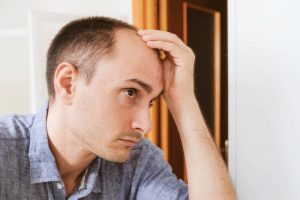 Male Pattern Baldness: Is There a Way to Win Against Hair Loss?