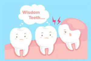 How To Sleep After Wisdom Teeth Removal?