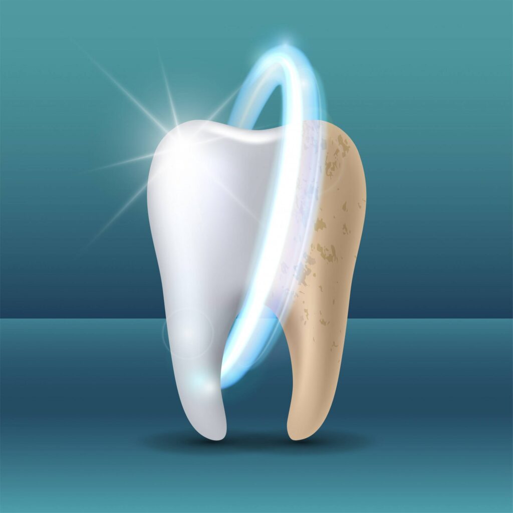 What Is Tooth Enamel