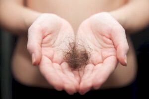 5 Surprising Reasons Behind Hair Loss